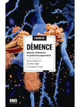 DÉMENCE : L'ESSENTIEL