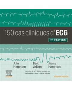150 cas cliniques d'ECG