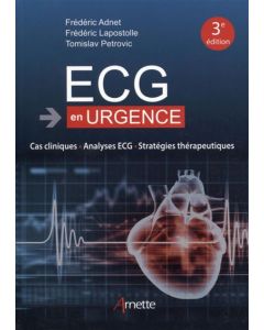 ECG EN URGENCE